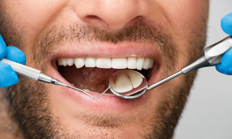 Healthy white male smile with a periodontal probe and mouth mirror, close-up. Teeth treatment. Shot